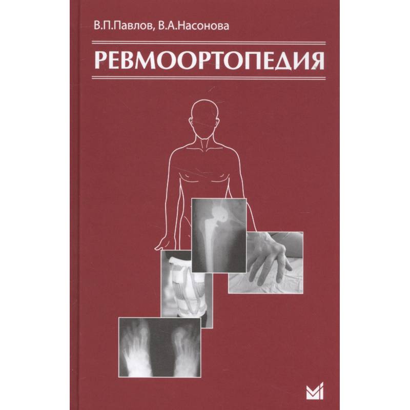 Ревмоортопедия