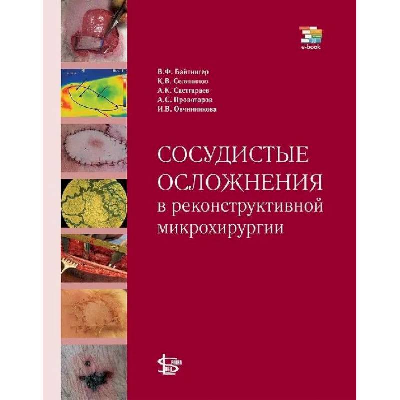 Сосудистые осложнения в реконструктивной микрохирургии