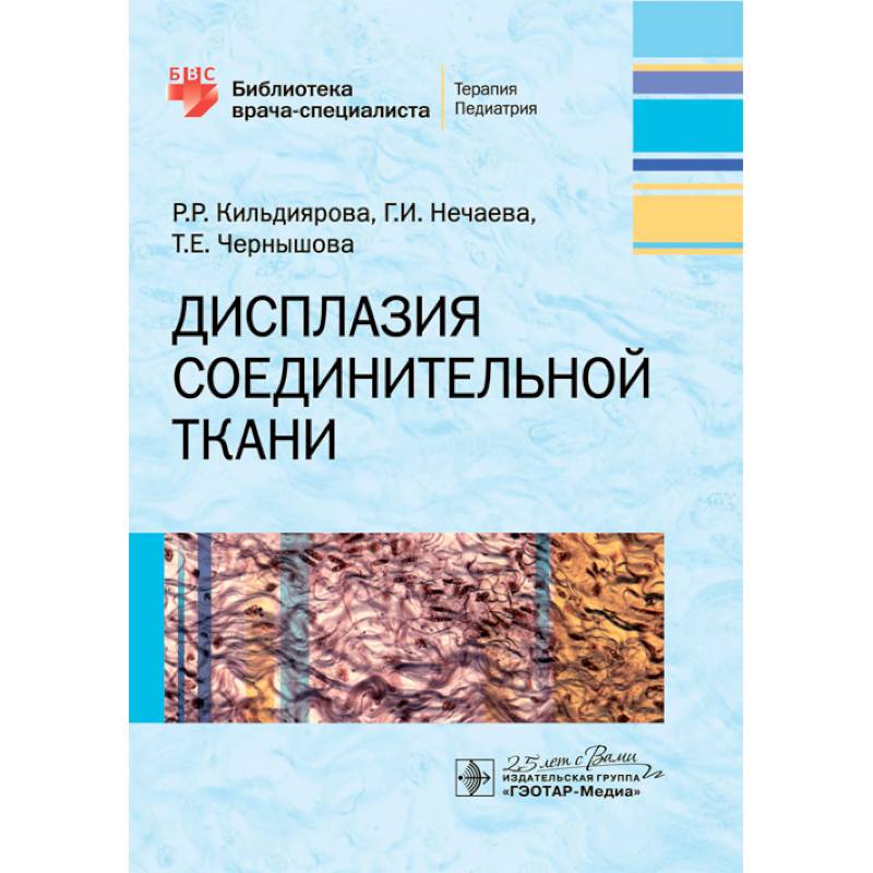Дисплазия соединительной ткани Дисплазия соединительной ткани