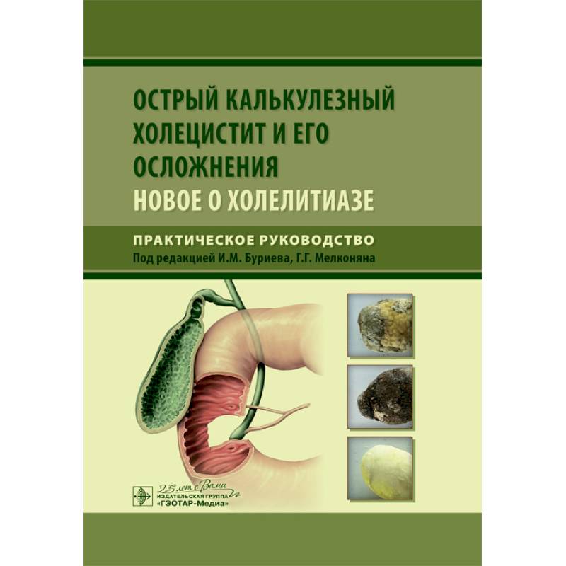 Хронический холецистит сим. Болезни печени презентация. Холецистит отзывы. Острый холецистит с перитонитом. Холецистит отзывы.