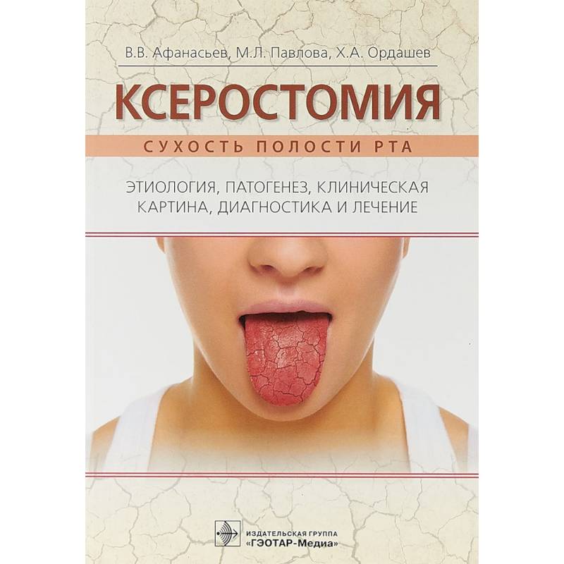 Чем лечить сухость во рту. Лекарство от ксеростомии. Ксеростомия (сухость в полости рта). Средства для полости рта при ксеростомии.