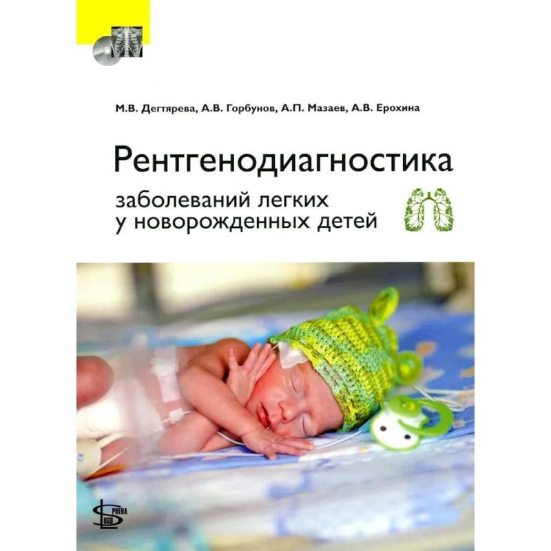 Рентгенодиагностика заболеваний легких у новорожденных детей. + DVD
