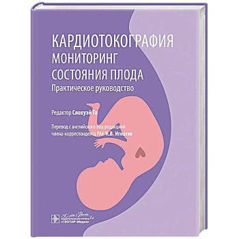 Кардиотокография. Мониторинг состояния плода. Практическое руководство