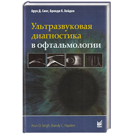 УЗИ. ЭКГ. Томография. Рентген, книга Ультразвуковая диагностика в офтальмологии купить по скидке