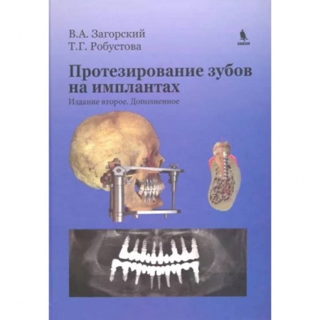 Стоматология, книга Протезирование зубов на имплантатах купить по скидке