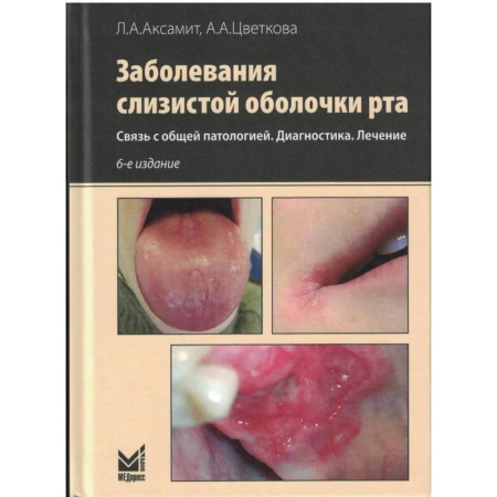 Медицинские энциклопедии и справочники, книга Заболевания слизистой оболочки рта. Связь с общей патологией. Диагностика. Лечение купить по скидке