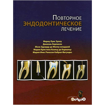 Повторное эндодонтическое лечение